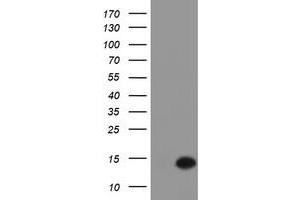 Western Blotting (WB) image for anti-Chromosome 17 Open Reading Frame 37 (C17orf37) antibody (ABIN1501784) (C17orf37 anticorps)