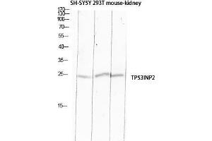 Western Blot (WB) analysis of SH-SY5Y 293T Mouse Kidney lysis using TP53INP2 antibody. (TP53INP2 anticorps)