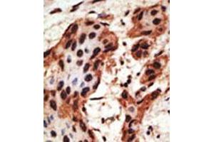 Image no. 2 for anti-Gap Junction Protein, beta 6, 30kDa (GJB6) (AA 95-124), (N-Term) antibody (ABIN357095)