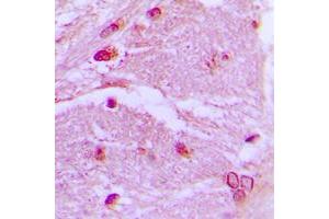 Immunohistochemical analysis of CSRP1 staining in human brain formalin fixed paraffin embedded tissue section.