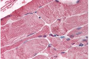 Human Skeletal Muscle (formalin-fixed, paraffin-embedded) stained with BMI1 antibody ABIN292553 at 2. (BMI1 anticorps  (AA 252-264))