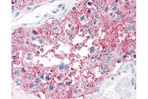 Anti-SRPX2 antibody IHC of human testis.