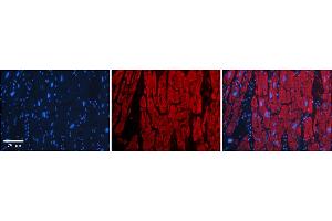Rabbit Anti-OTUD7B Antibody    Formalin Fixed Paraffin Embedded Tissue: Human Adult heart  Observed Staining: Cytoplasmic Primary Antibody Concentration: 1:600 Secondary Antibody: Donkey anti-Rabbit-Cy2/3 Secondary Antibody Concentration: 1:200 Magnification: 20X Exposure Time: 0.
