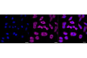 Immunocytochemical staining of HepG2 cells with AGR2 antibody (ABIN7797627), 1:1,000). (Recombinant AGR2 anticorps)