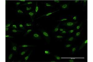 Immunofluorescence of monoclonal antibody to LMO4 on HeLa cell.