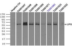 Image no. 1 for anti-Lipase, Endothelial (LIPG) antibody (ABIN1499169) (LIPG anticorps)
