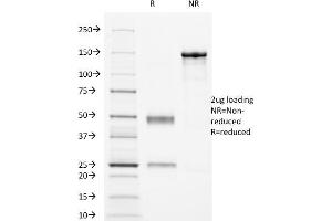 SDS-PAGE Analysis Purified CD16 Mouse Monoclonal Antibody (HuNK2). (FCGR3A anticorps)
