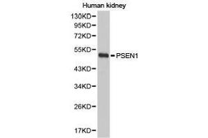 Western Blotting (WB) image for anti-Presenilin 1 (PSEN1) antibody (ABIN1874357) (Presenilin 1 anticorps)