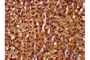 IHC image of ABIN7157812 diluted at 1:200 and staining in paraffin-embedded human adrenal gland tissue performed on a Leica BondTM system. (LARP6 anticorps  (AA 294-453))