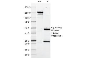 SDS-PAGE Analysis Purified CD106 Monoclonal Antibody (1.