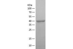 Western Blotting (WB) image for Malic Enzyme 1, NADP(+)-Dependent, Cytosolic (ME1) (AA 226-572) protein (His tag) (ABIN7123839)
