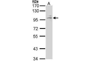 WB Image Sample (30 ug of whole cell lysate) A: A431 , 7.