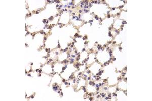 Immunohistochemistry of paraffin-embedded mouse lung using TSC22D3 Antibody.