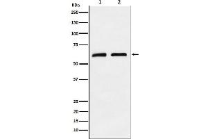 Western blot analysis of CLPX expression in (1) A673 cell lysate, (2) Mouse brain lysate.