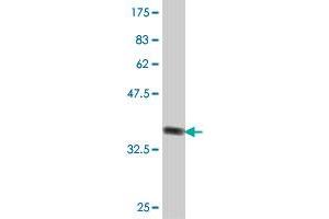 Western Blot detection against Immunogen (37.