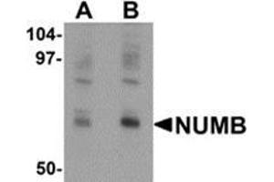 Western blot analysis of NUMB in mouse lung tissue lysate with NUMB antibody at (A) 0. (NUMB anticorps  (C-Term))
