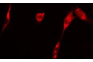 ABIN6266696 staining 293 cells by IF/ICC.