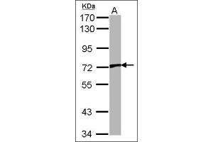 Sample (30 µg of whole cell lysate).