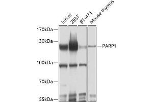 Western blot analysis of extracts of various cell lines, using P antibody (ABIN6134593, ABIN6145233, ABIN6145235 and ABIN6215036) at 1:1000 dilution. (PARP1 anticorps  (AA 150-250))