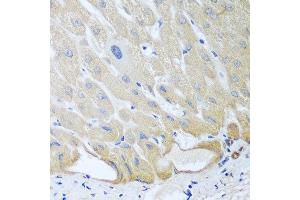 Immunohistochemistry of paraffin-embedded human liver using IGFBP4 antibody at dilution of 1:100 (40x lens). (IGFBP4 anticorps)