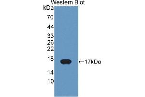 Detection of Recombinant CYP11A1, Bovine using Polyclonal Antibody to Cytochrome P450 11A1 (CYP11A1) (CYP11A1 anticorps  (AA 391-515))