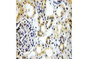 Immunohistochemistry (IHC) image for anti-Tight Junction Protein 1 (TJP1) (AA 1600-1700) antibody (ABIN1513706) (TJP1 anticorps  (AA 1600-1700))