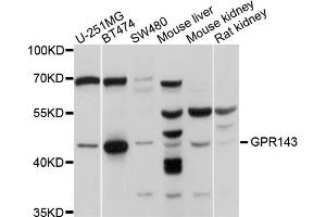 Western blot analysis of extracts of various cell lines, using GPR143 antibody. (GPR143 anticorps)