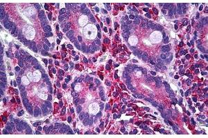 Human Small Intestine: Formalin-Fixed, Paraffin-Embedded (FFPE)