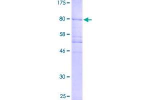 Image no. 1 for Centrosomal Protein 57kDa (CEP57) (AA 1-500) protein (GST tag) (ABIN1349152)