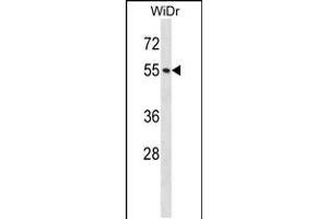 Western blot analysis in WiDr cell line lysates (35ug/lane). (NUP50 anticorps  (AA 224-252))