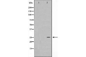Western blot analysis on HeLa cell lysate using EFNA5 Antibody,The lane on the left is treated with the antigen-specific peptide. (Ephrin A5 anticorps  (Internal Region))