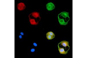 ABIN7094964 and ABIN7099020 staining  cells by IF/ICC.