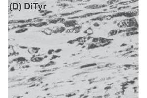 Immunohistochemistry image of dityrosine staining in paraffin section of human atherosclerotic lesion. (Dityrosine anticorps)