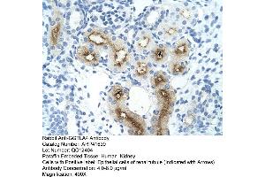 Rabbit Anti-GGTLA4 Antibody  Paraffin Embedded Tissue: Human Kidney Cellular Data: Epithelial cells of renal tubule Antibody Concentration: 4. (GGTLC1 anticorps  (C-Term))