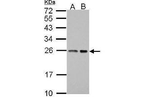 WB Image Sample (30 ug of whole cell lysate) A: A431 B: HeLa 12% SDS PAGE antibody diluted at 1:1000 (BAG2 anticorps)
