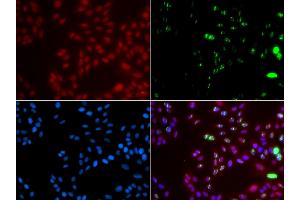 Immunofluorescence analysis of GFP-RNF168 transgenic U2OS cells using XPA antibody. (XPA anticorps)