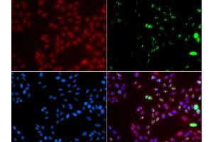 Immunofluorescence analysis of GFP-RNF168 transgenic U2OS cells using XPA antibody. (XPA anticorps)