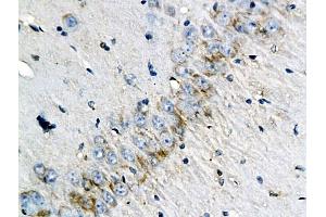 Formalin-fixed and paraffin embedded rat brain labeled with Anti-CD46/MCP (human) Polyoclonal Antibody, Unconjugated (ABIN687832) at 1:200 followed by conjugation to the secondary antibody and DAB staining