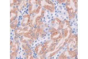 Used in DAB staining on fromalin fixed paraffin- embedded kidney tissue