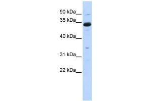 Copine I antibody used at 1 ug/ml to detect target protein. (CPNE1 anticorps  (Middle Region))
