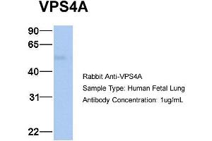Host: Rabbit Target Name: VPS4A Sample Type: Human Fetal Lung Antibody Dilution: 1. (VPS4A anticorps  (N-Term))