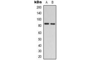 Western blot analysis of RAD54A expression in Jurkat (A), HEK293T (B) whole cell lysates. (RAD54L anticorps)