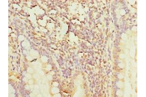 Immunohistochemistry of paraffin-embedded human small intestine tissue using ABIN7150446 at dilution of 1:100 (POLR3A anticorps  (AA 392-632))