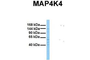 Host:  Rabbit  Target Name:  MAP4K4  Sample Tissue:  Human Stomach Tumor  Antibody Dilution:  1. (MAP4K4 anticorps  (N-Term))