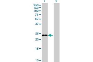 Western Blot analysis of OIP5 expression in transfected 293T cell line by OIP5 MaxPab polyclonal antibody. (OIP5 anticorps  (AA 1-229))