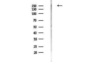 anti-AT Rich Interactive Domain 1A (SWI-Like) (ARID1A) (Internal Region) antibody