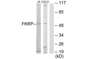 Western blot analysis of extracts from Jurkat cells and COLO205 cells, using FKRP antibody. (FKRP anticorps  (N-Term))