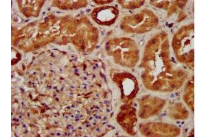 IHC image of ABIN7170916 diluted at 1:300 and staining in paraffin-embedded human kidney tissue performed on a Leica BondTM system. (SUCLG2 anticorps  (AA 161-292))