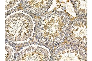 ABIN7095482 and ABIN7099539 at 1/100 staining rat testis tissue by IHC-P.