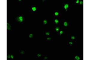 Immunofluorescence staining of U251 cells with ABIN7151309 at 1:100, counter-stained with DAPI. (UHRF2 anticorps  (AA 444-585))